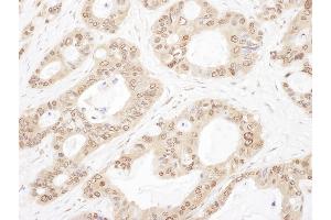 Immunohistochemistry (IHC) image for anti-Opioid Growth Factor Receptor (OGFR) (AA 627-677) antibody (ABIN7455050) (OGFR Antikörper  (AA 627-677))