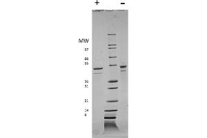 SDS-PAGE of Human Visfatin Recombinant Protein SDS-PAGE of Human Visfatin Recombinant Protein. (NAMPT Protein)