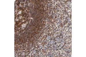 Immunohistochemical staining of human spleen with WIPF1 polyclonal antibody  shows strong cytoplasmic positivity in cells in red pulp and cells in white pulp. (WIPF1 Antikörper)