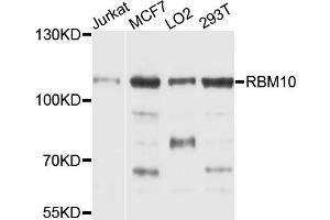 Western blot analysis of extracts of various cell lines, using RBM10 antibody (ABIN1874563) at 1:1000 dilution. (RBM10 Antikörper)