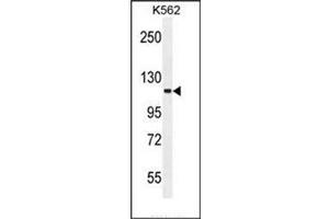 Western Blotting (WB) image for anti-SKI Family Transcriptional Corepressor 2 (SKOR2) (AA 877-906), (C-Term) antibody (ABIN952407)