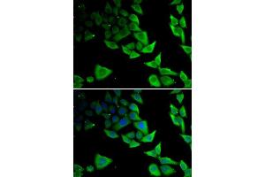 Immunofluorescence analysis of MCF-7 cells using SNCA antibody. (SNCA Antikörper  (AA 61-140))