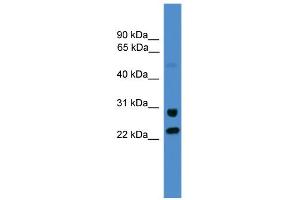 WB Suggested Anti-KIAA0152 Antibody Titration:  0.