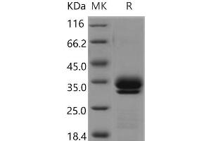 Western Blotting (WB) image for Kallikrein 7 (KLK7) (Active) protein (His tag) (ABIN7320112) (Kallikrein 7 Protein (KLK7) (His tag))