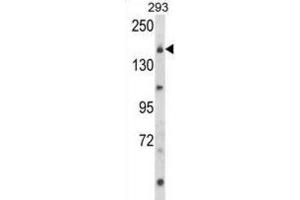 Western Blotting (WB) image for anti-Unc-13 Homolog B (UNC13B) antibody (ABIN3003956)