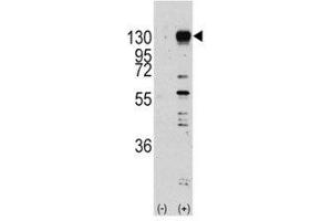 Western Blotting (WB) image for anti-Fibroblast Growth Factor Receptor 1 (FGFR1) (AA 631-660) antibody (ABIN3030948)
