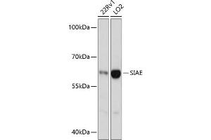 Western blot analysis of extracts of various cell lines, using SIAE antibody (ABIN6132918, ABIN6147755, ABIN6147756 and ABIN6217135) at 1:3000 dilution. (SIAE Antikörper  (AA 270-450))