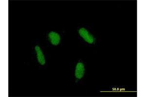 Immunofluorescence of purified MaxPab antibody to ZNF436 on HepG2 cell. (ZNF436 Antikörper  (AA 1-470))