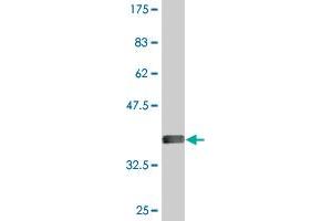 Western Blot detection against Immunogen (36. (ODF2 Antikörper  (AA 706-804))