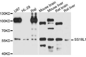 Western blot analysis of extract of various cells, using SS18L1 antibody. (SS18L1 Antikörper)