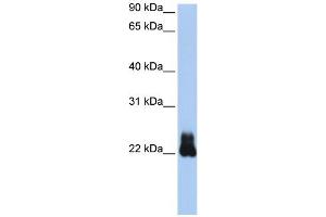 WB Suggested Anti-RHOD Antibody Titration:  0. (RHOD Antikörper  (N-Term))