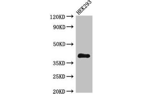 DHRS13 Antikörper  (AA 1-327)