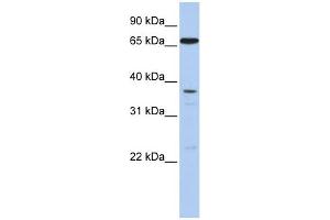 WB Suggested Anti-ABCB9 Antibody Titration:  0.