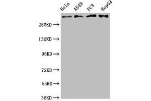 Western Blot Positive WB detected in: Hela whole cell lysate, A549 whole cell lysate, PC3 whole cell lysate, HepG2 whole cell lysate All lanes: ATM antibody at 2. (Rekombinanter ATM Antikörper)