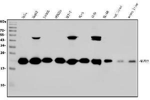 Western blot analysis of NDUFB10 using anti-NDUFB10 antibody (ABIN7601461).