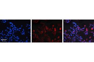 Immunohistochemistry (IHC) image for anti-Sphingolipid Delta(4)-Desaturase DES1 (DEGS1) (N-Term) antibody (ABIN405745) (DEGS1 Antikörper  (N-Term))