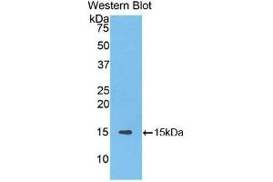 Western Blotting (WB) image for anti-Solute Carrier Family 30 (Zinc Transporter), Member 8 (SLC30A8) (AA 263-369) antibody (ABIN1176292) (SLC30A8 Antikörper  (AA 263-369))