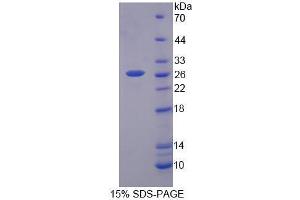 Image no. 1 for Bestrophin 2 (BEST2) (AA 320-509) protein (His tag) (ABIN6239683) (Bestrophin 2 Protein (BEST2) (AA 320-509) (His tag))