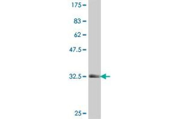 5HT1B Receptor Antikörper  (AA 1-49)