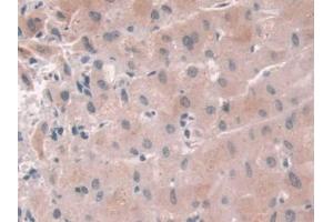 DAB staining on IHC-P; Samples: Human Liver Tissue (USP6NL Antikörper  (AA 1-292))