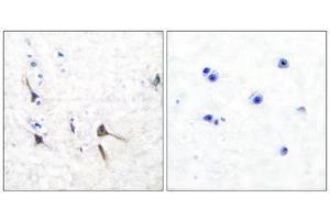 Immunohistochemistry (IHC) image for anti-Kv3.2b Potassium Channel (C-Term) antibody (ABIN1848746) (Kv3.2b Potassium Channel Antikörper  (C-Term))