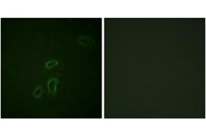 Immunofluorescence analysis of HepG2 cells, using CD171/N-CAML1 (Ab-1181) Antibody. (L1CAM Antikörper  (AA 1147-1196))