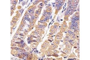 IHC analysis of FFPE mouse stomach section using Ror2 antibody; Ab was diluted at 1:25. (ROR2 Antikörper  (AA 750-800))