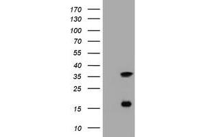 Image no. 5 for anti-Thymidylate Synthetase (TYMS) antibody (ABIN1501589) (TYMS Antikörper)