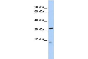 WB Suggested Anti-C14orf80 Antibody Titration: 0. (C14ORF80 Antikörper  (N-Term))
