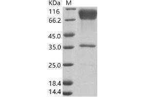 Zaire Ebola Virus Envelope Glycoprotein (ZEBOV GP) protein (Fc Tag)