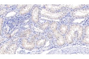 Detection of C1qB in Human Kidney Tissue using Polyclonal Antibody to Complement Component 1, Q Subcomponent B (C1qB) (C1QB Antikörper  (AA 28-253))
