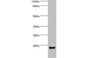 Western blot All lanes: Urotensin-2 antibody at 8 μg/mL + Rat brain tissue Secondary Goat polyclonal to rabbit IgG at 1/10000 dilution Predicted band size: 15, 17 kDa Observed band size: 15 kDa (Urotensin 2 Antikörper  (AA 35-124))