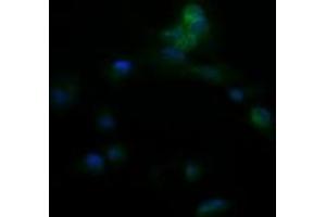 Image no. 2 for anti-Amyloid P Component, Serum (APCS) antibody (ABIN1500900) (APCS Antikörper)