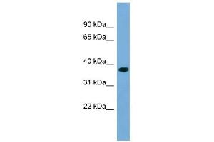 RPRD1B antibody used at 1 ug/ml to detect target protein. (RPRD1B Antikörper  (Middle Region))