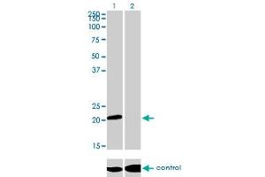 Western blot analysis of ATF3 over-expressed 293 cell line, cotransfected with ATF3 Validated Chimera RNAi (Lane 2) or non-transfected control (Lane 1).