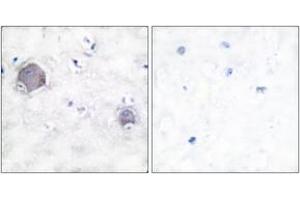 Immunohistochemistry (IHC) image for anti-Notch 1 (NOTCH1) (AA 1735-1784), (Cleaved-Val1744) antibody (ABIN2891164) (Notch1 Antikörper  (Cleaved-Val1744))
