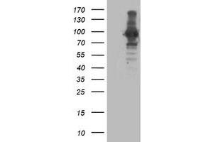 Western Blotting (WB) image for anti-Anaphase Promoting Complex Subunit 2 (ANAPC2) antibody (ABIN1496636)