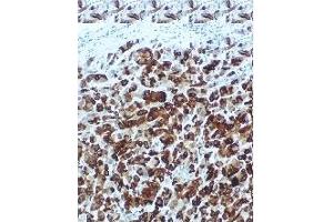 Immunohistochemistry (IHC) image for anti-Secretoglobin, Family 2A, Member 2 (SCGB2A2) antibody (ABIN452654) (Mammaglobin A Antikörper)