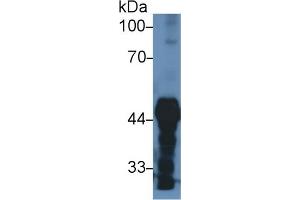 Western Blotting (WB) image for anti-Pyruvate Dehydrogenase (Lipoamide) alpha 1 (PDHA1) (AA 30-390) antibody (ABIN7432574)
