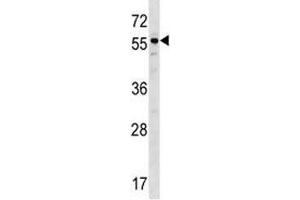 BMP3 antibody western blot analysis in ZR-75-1 lysate. (BMP3 Antikörper  (AA 318-347))