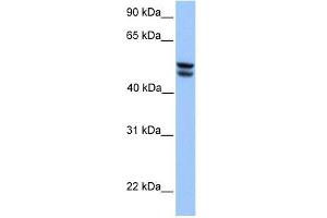 OXCT1 antibody used at 1 ug/ml to detect target protein. (OXCT1 Antikörper  (Middle Region))