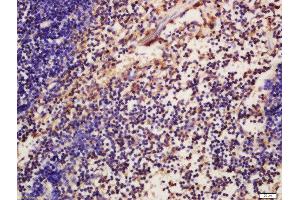 Formalin-fixed and paraffin embedded mouse spleen labeled with Anti-phospho-ATG16A(Ser287)Polyclonal Antibody, Unconjugated  at 1:200 followed by conjugation to the secondary antibody and DAB staining (ATG16L1 Antikörper  (pSer287))