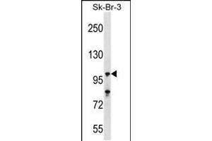 Western blot analysis in SK-BR-3 cell line lysates (35ug/lane). (USP16 Antikörper  (N-Term))