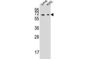 Western Blotting (WB) image for anti-Dihydropyrimidinase (DPYS) antibody (ABIN2997327) (DPYS Antikörper)
