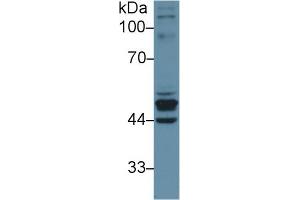 Western Blot; Sample: Human Placenta lysate; Primary Ab: 1µg/ml Rabbit Anti-Human KRT23 Antibody Second Ab: 0.