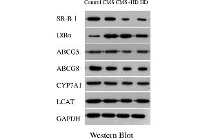The results of qPCR showed that high fat diet (HD) significantly decreased the expression of LXRα, ABCG5, ABCG8, SR-BI, CYP7A1 and LCAT,and CMS alone significantly elevated the expression of LXRα, ABCG5, ABCG8, and SR-BI, while CMS + HD significantly decreased the expression of ABCG5, ABCG8, CYP7A1 and LCAT. (CYP7A1 Antikörper  (AA 351-400))