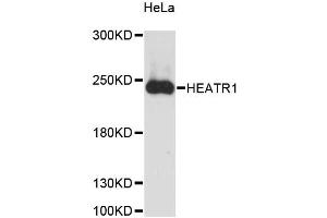 Western blot analysis of extracts of HeLa cells, using HEATR1 antibody (ABIN6290508) at 1:3000 dilution. (HEATR1 Antikörper)
