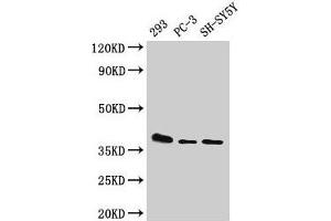 Western Blot Positive WB detected in: 293 whole cell lysate, PC-3 whole cell lysate, SH-SY5Y whole cell lysate All lanes: ELOVL4 antibody at 1:500 Secondary Goat polyclonal to rabbit IgG at 1/50000 dilution Predicted band size: 37 kDa Observed band size: 37 kDa (ELOVL4 Antikörper  (AA 270-314))