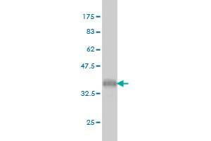 Western Blot detection against Immunogen (36. (UHRF1 Antikörper  (AA 694-793))