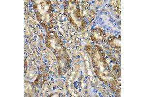 Immunohistochemistry of paraffin-embedded mouse kidney using NMT2 antibody at dilution of 1:100 (x400 lens). (NMT2 Antikörper)